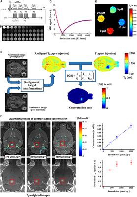 Assessing Diffusion in the Extra-Cellular Space of Brain Tissue by Dynamic MRI Mapping of Contrast Agent Concentrations